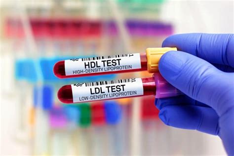 Decodarea unui test de sânge și a colesterolului